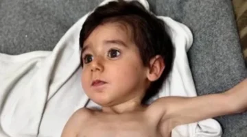 الطفل زين في غزة يعاني من سوء تغذية حاد يهدد حياته ويلقي الضوء على الأزمة الصحية المتفاقمة 1